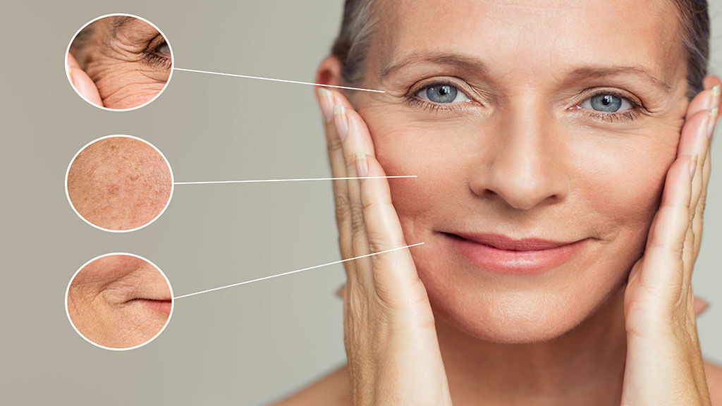 Zbliżenie na twarz starszej kobiety, uwydatniające naturalne niedoskonałości skóry takie jak zmarszczki, drobne linie oraz zmiany pigmentacyjne.